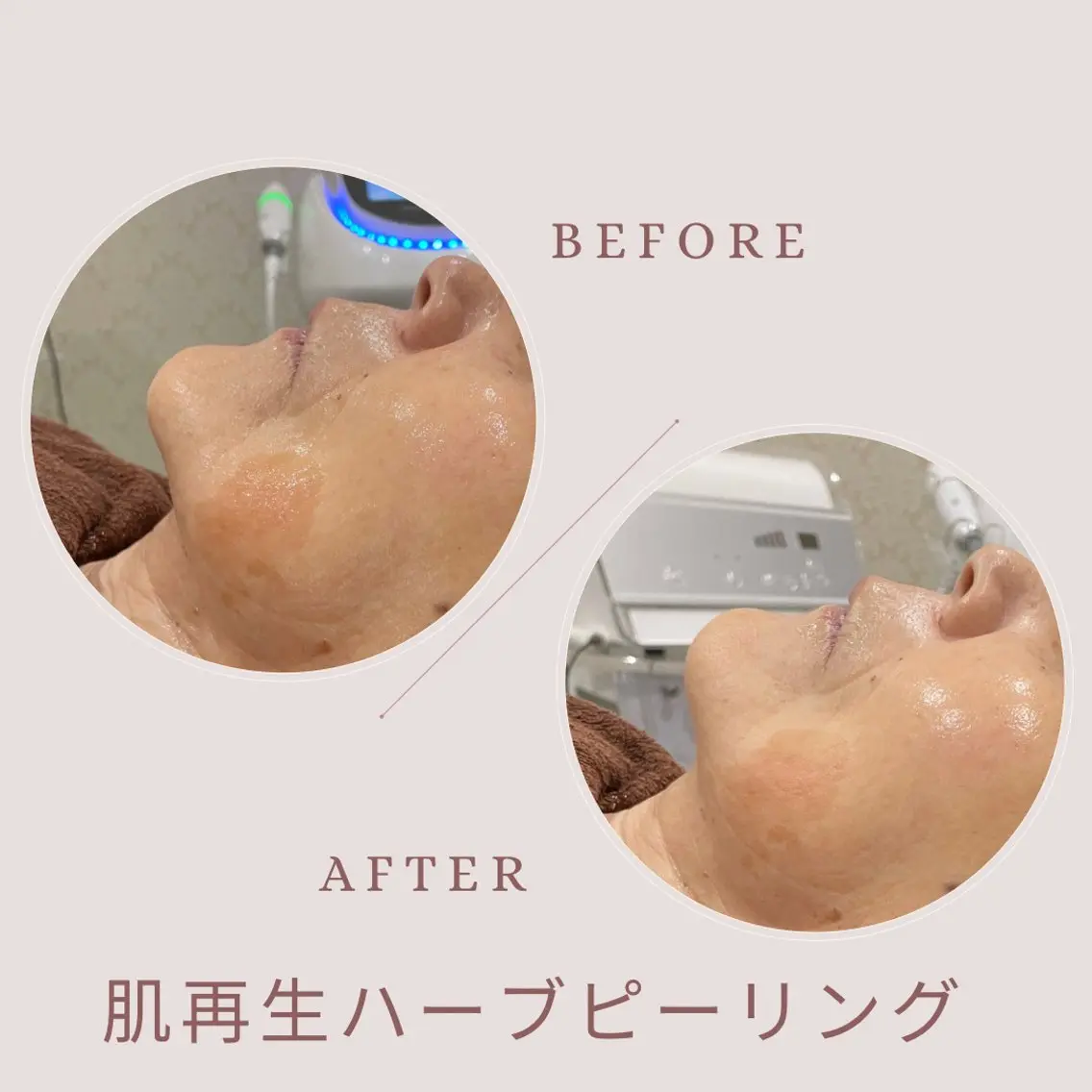 CUCURU hea lth×beautyのエステ・リラクイメージ
