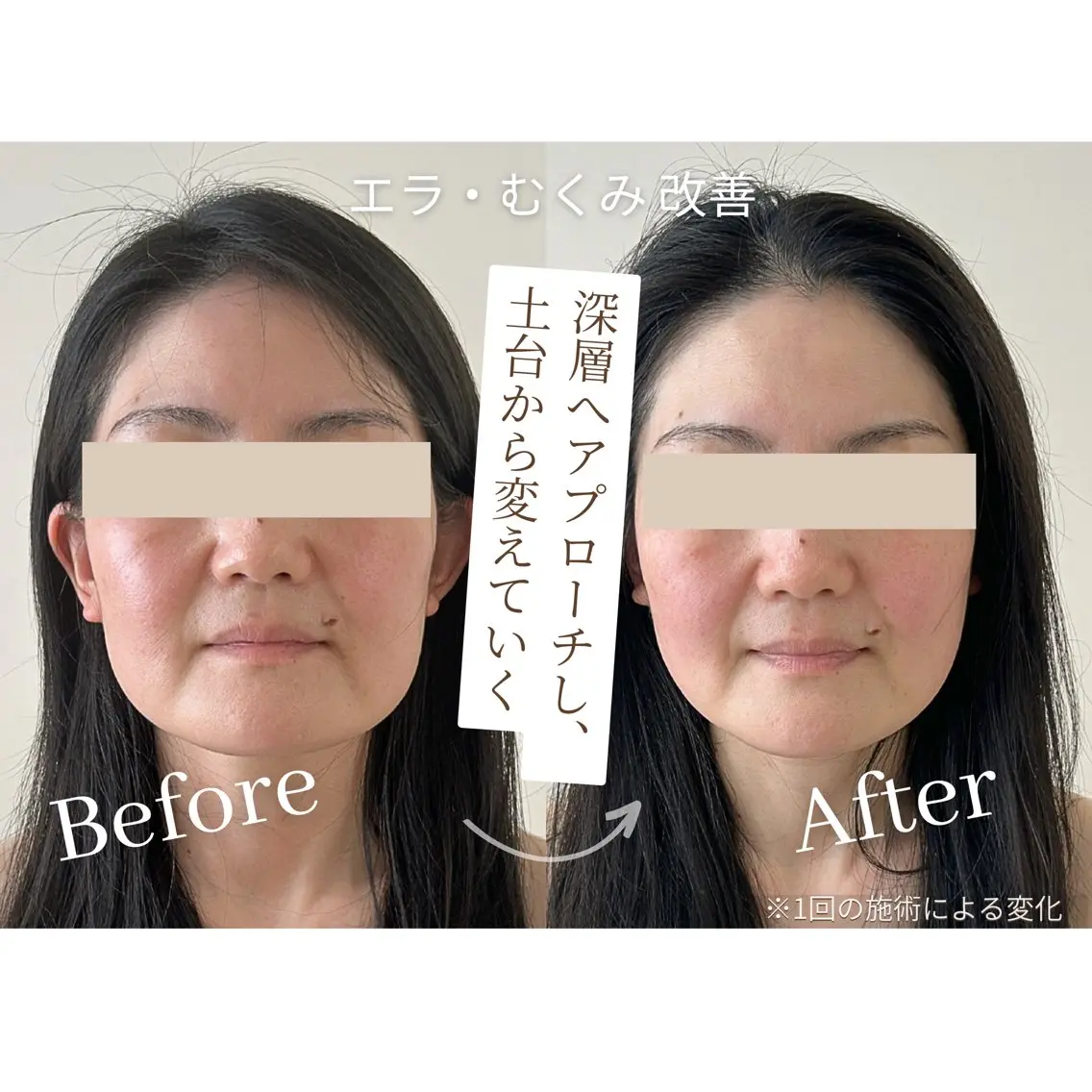 小顔コルギSalon de ETULEのエステ・リラクイメージ