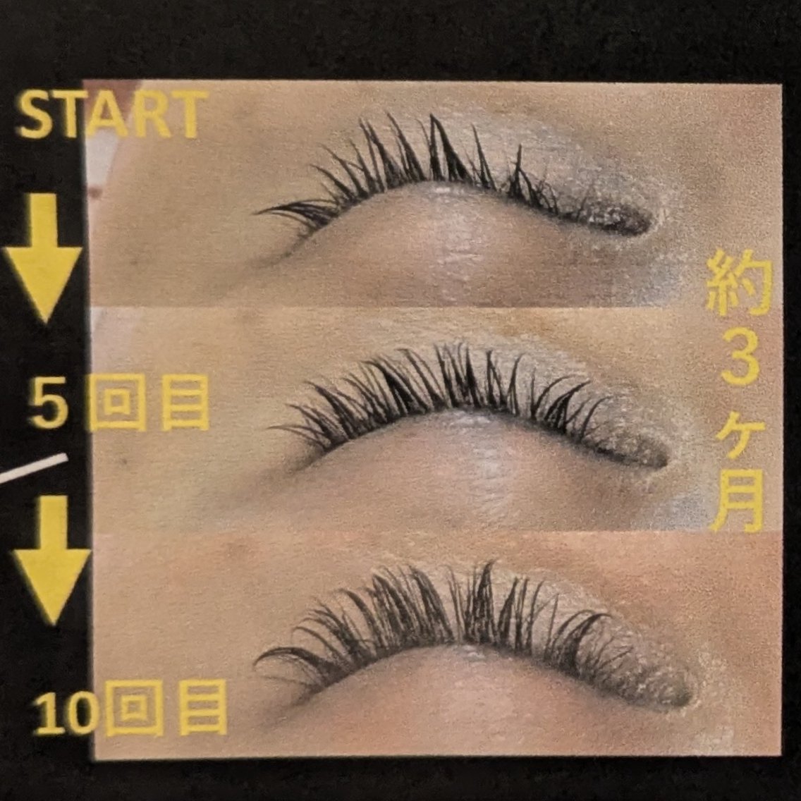 本気のまつ毛サロンケア！【5回コース】　💄ラッシュアディクト💄の写真
