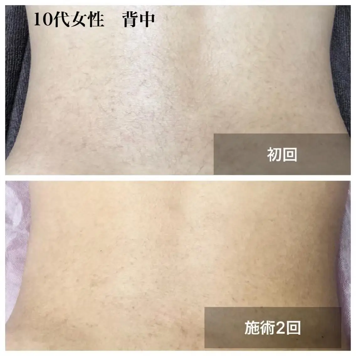 美容＆脱毛サロン 金沢文庫のエステ・リラクイメージ
