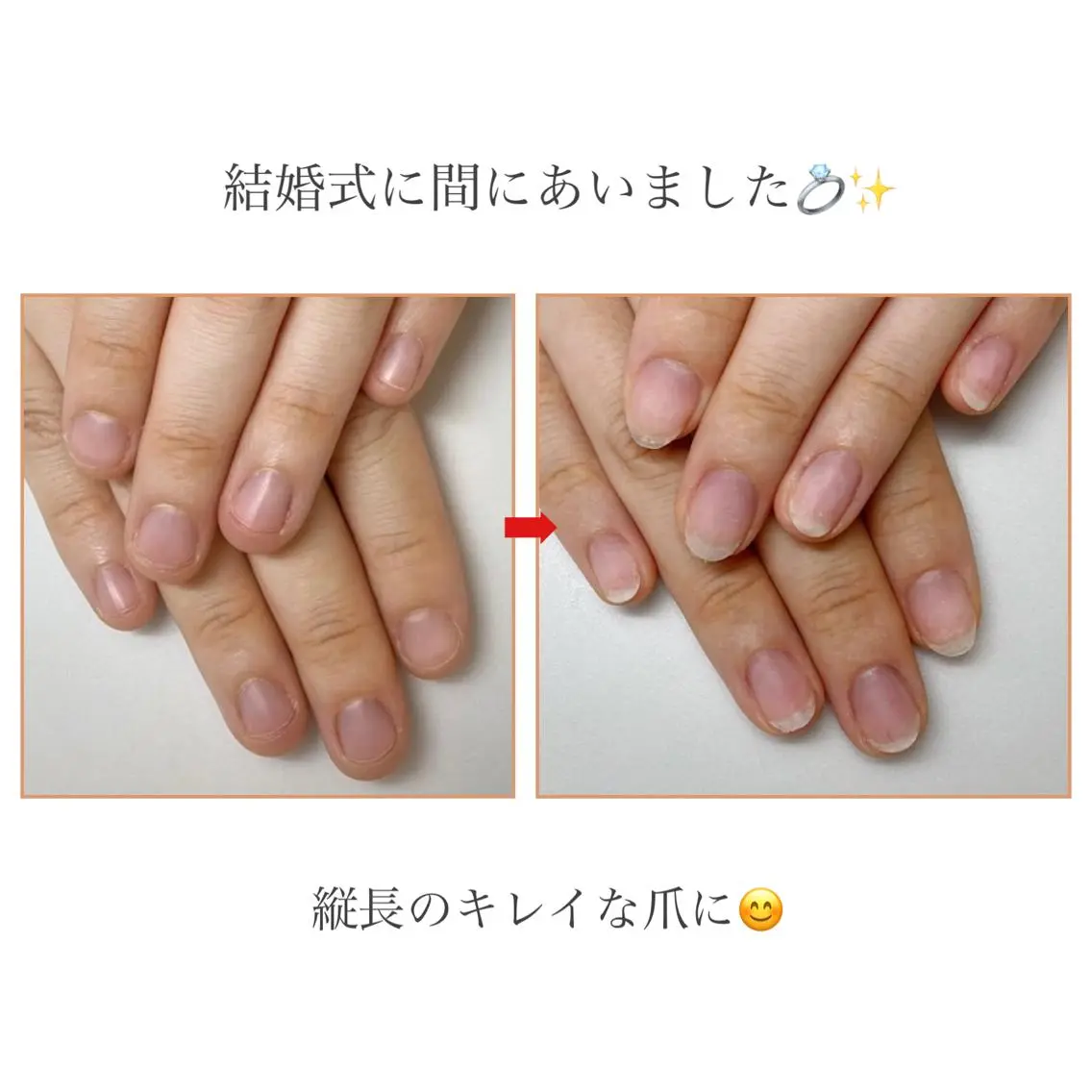 ネイル ネイルサロン アリュームのネイルデザイン