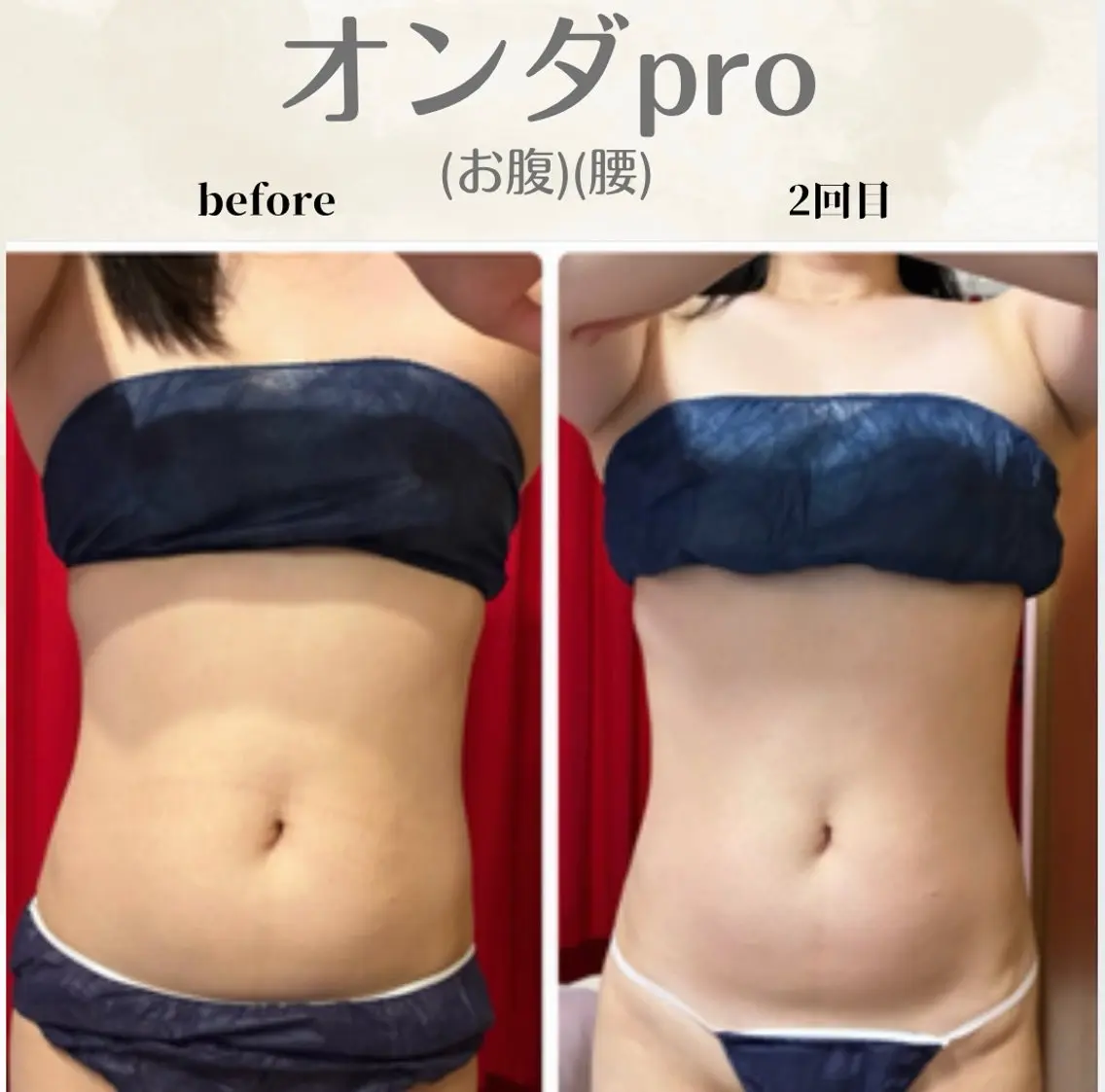 【お腹・腰】《当店イチオシ🩵》お腹なら絶対これ‼️浮き輪肉撃退!美くびれ集中ケア🔥の写真