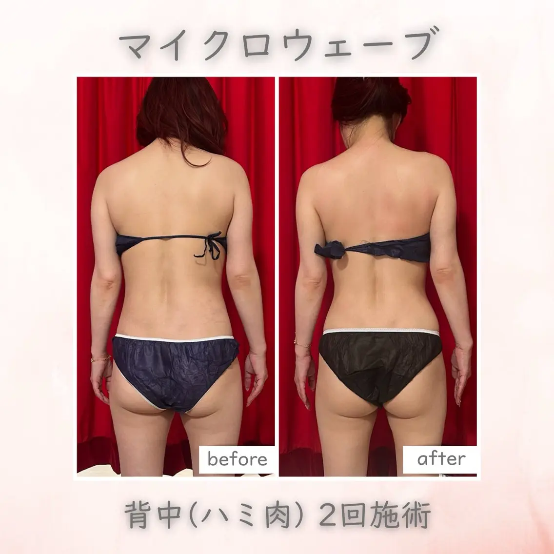 エステ リラク オンダリフト・美肌 Red しずるのエステ・リラクイメージ