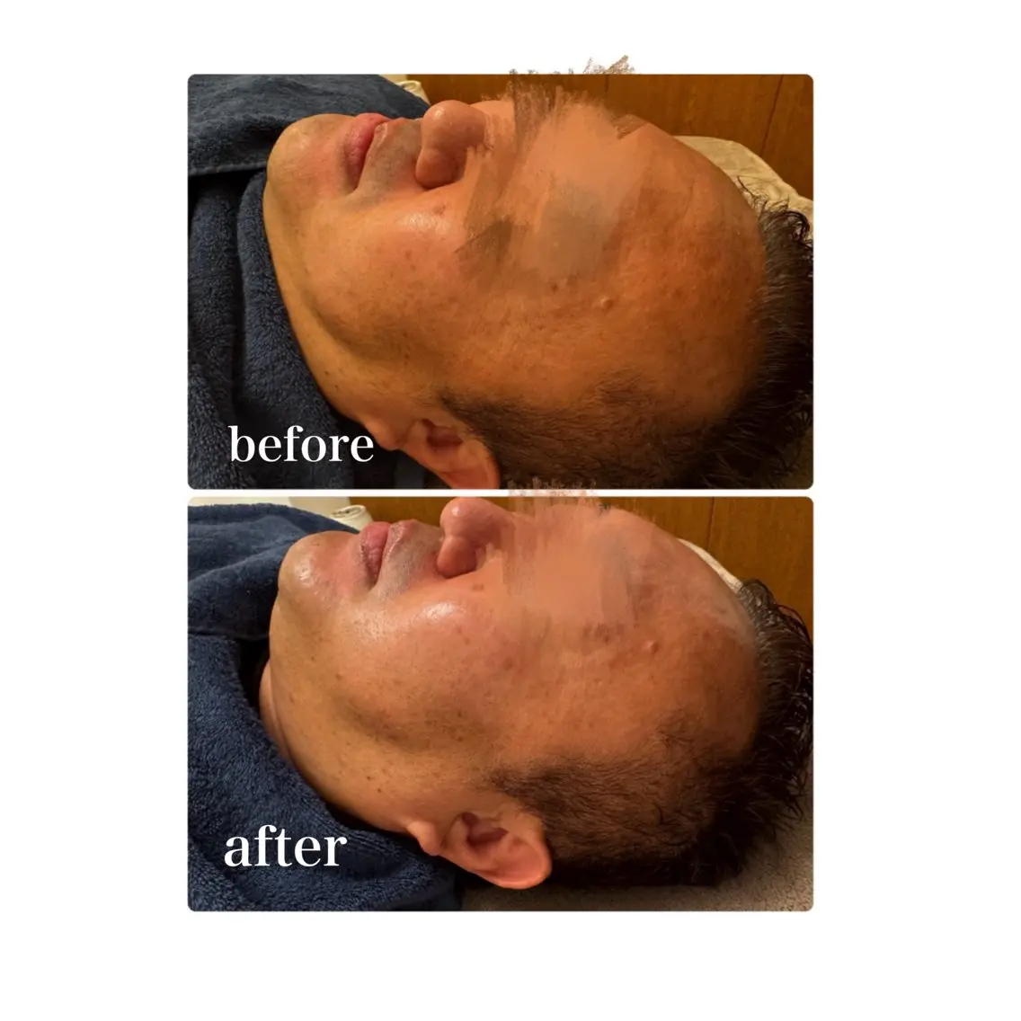 Esthesalon MOONのエステ・リラクイメージ