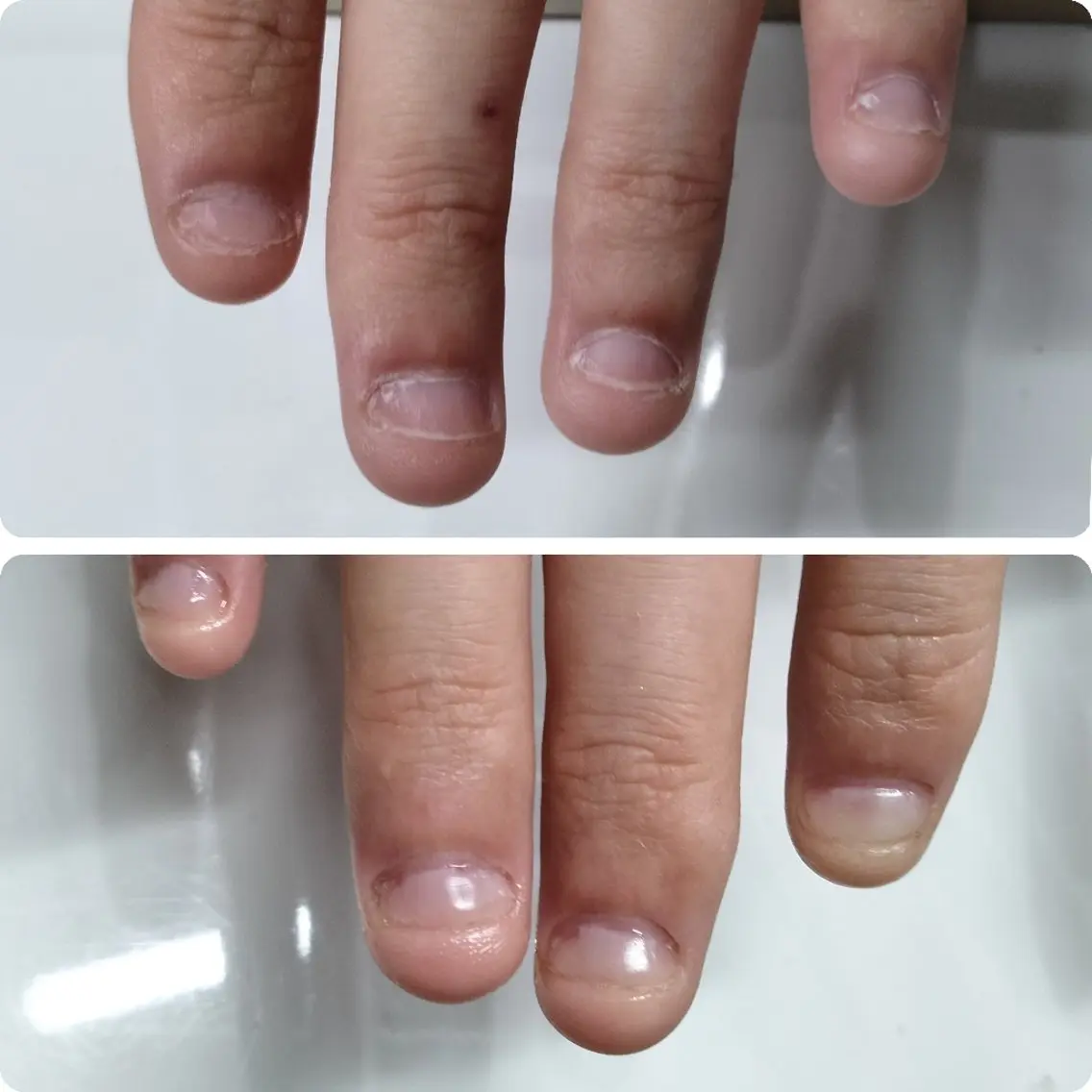 ネイル ネイルサロン アリュームのネイルデザイン