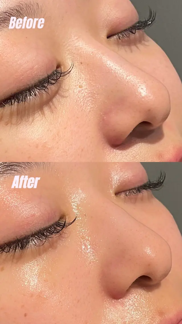 Pore care【毛穴集中】コースの写真