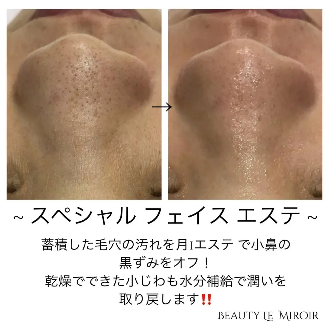 ビューティー ミロワールのエステ・リラクイメージ