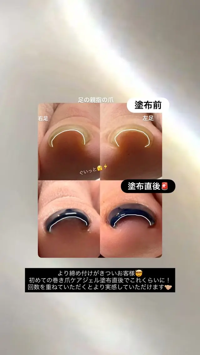 ネイル ジェルネイル フットネイル ZERO Nail Art Foot専用のネイルデザイン