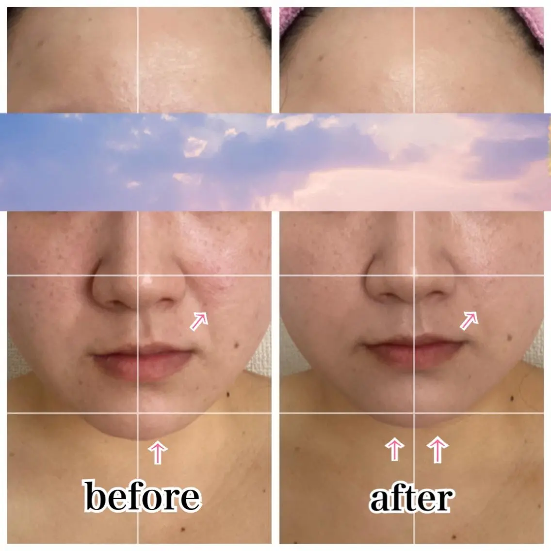 【小顔矯正】 salonaceのエステ・リラクイメージ