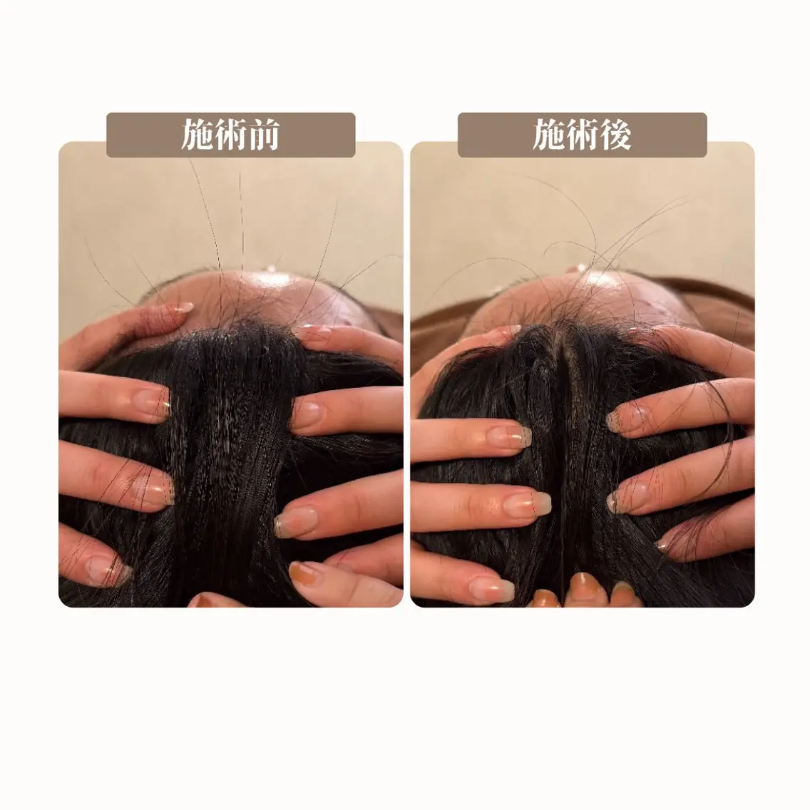 エステ BLANCIA 銀座のエステ・リラクイメージ