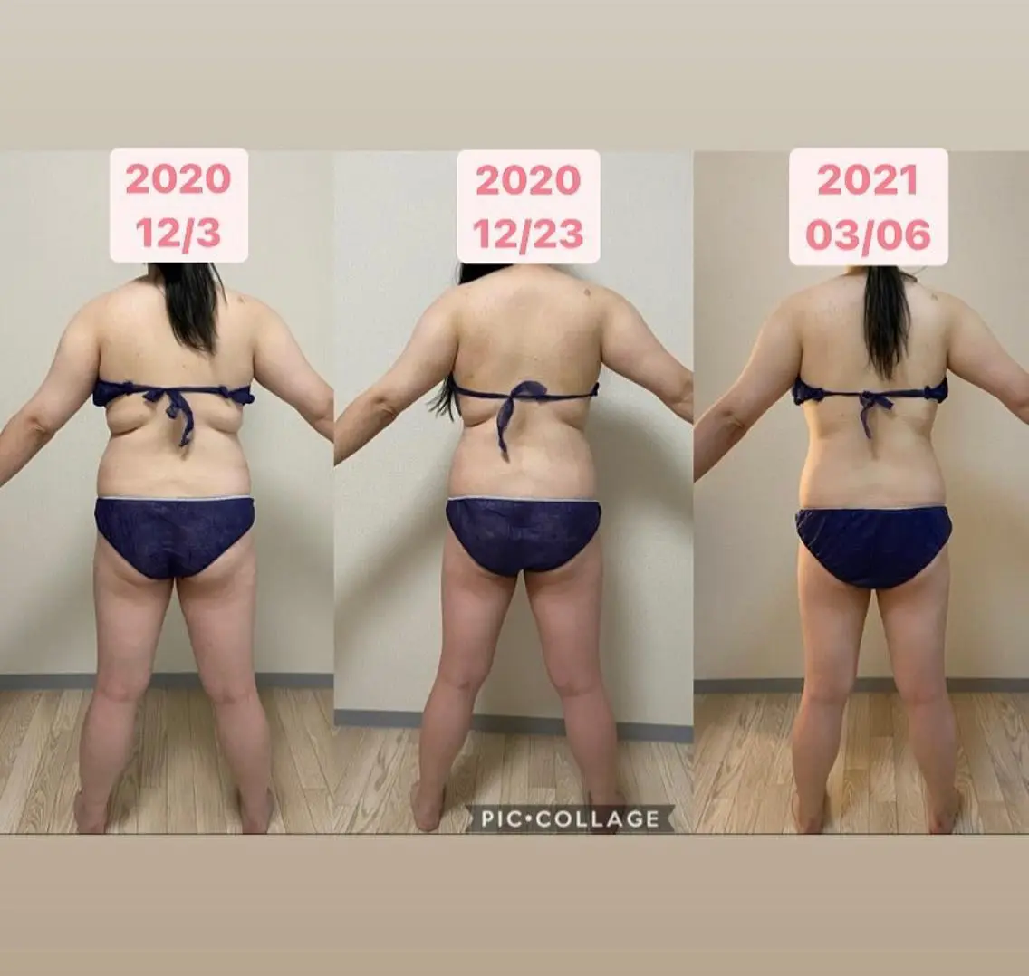 美容鍼WINBACK サロンRemeのエステ・リラクイメージ