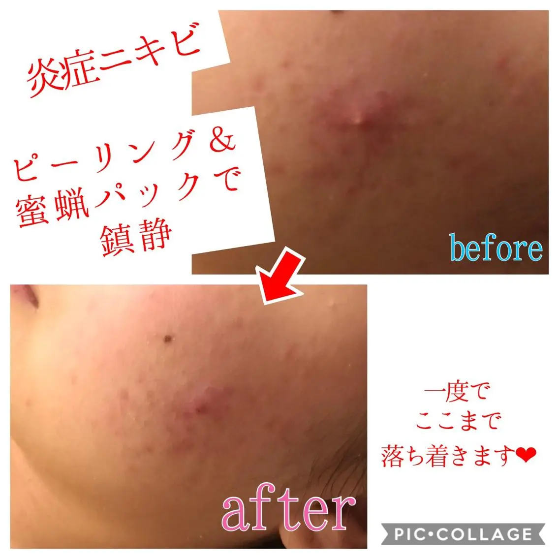 セミロング カラー パーマ ヘアアレンジ メンズ キッズ ネイル マツエク・マツパ 金の糸脱毛 産毛ケア専門のエステ・リラクイメージ