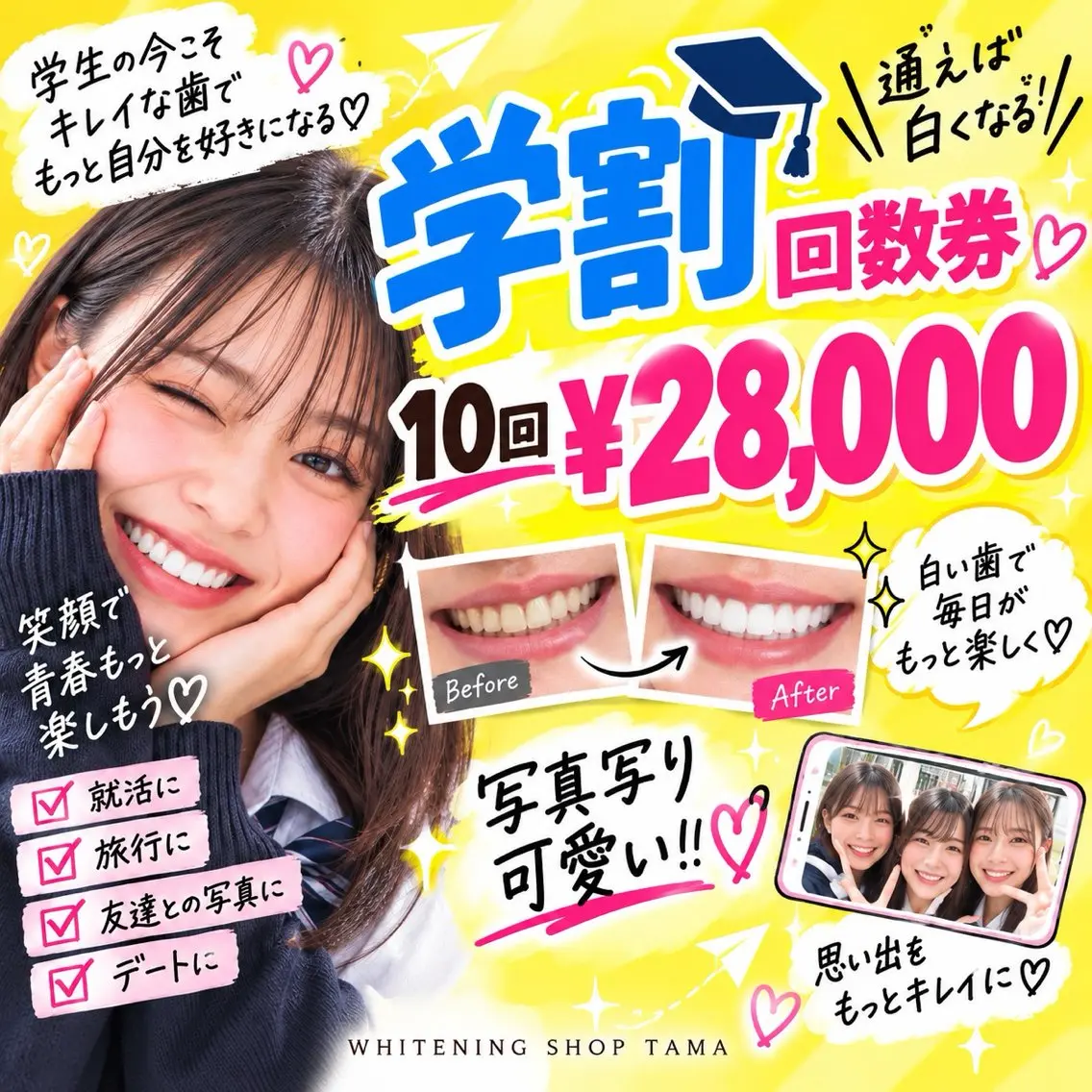 🎓学生限定✨通うほどお得！セルフホワイトニング10回券¥28,000🦷💕の写真