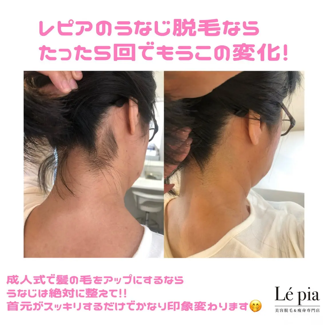 脱毛 美容脱毛専門店 Lé pia レピアのエステ・リラクイメージ