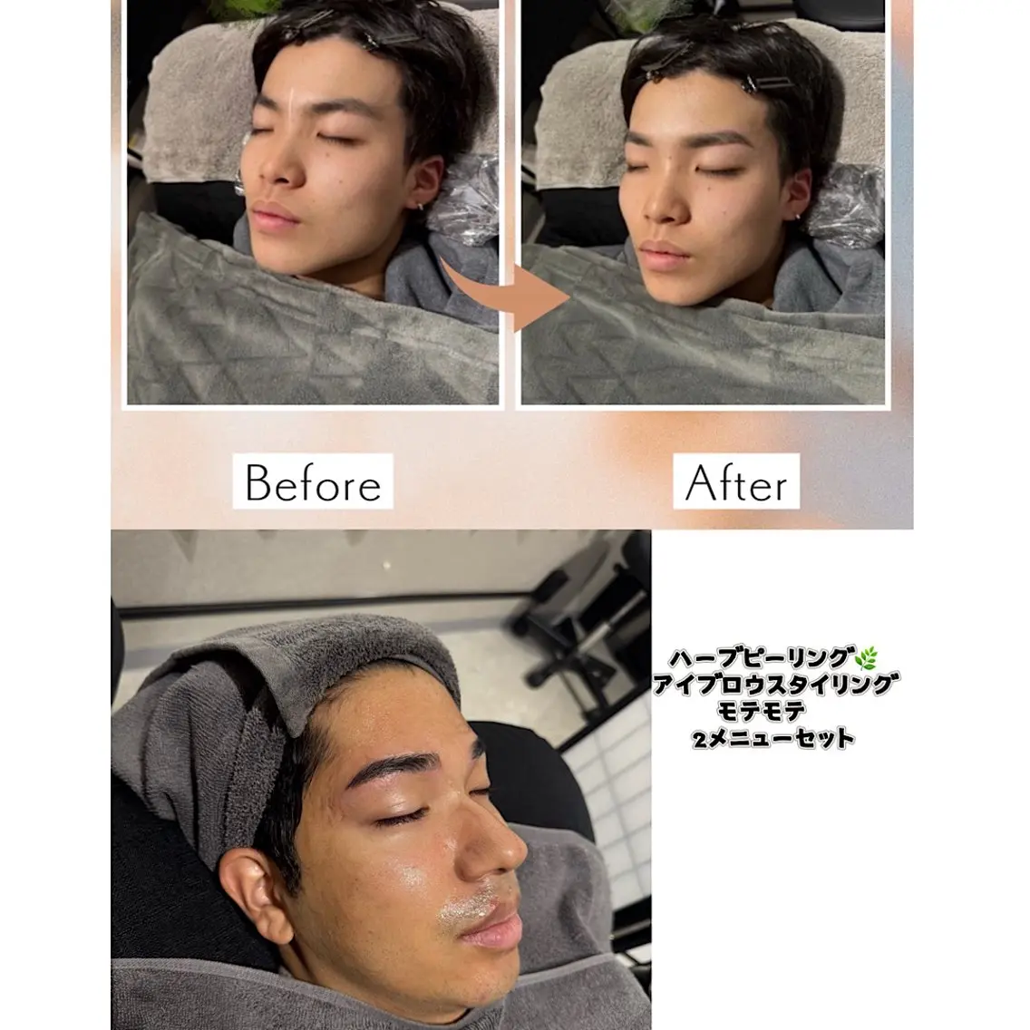 🉐1番人気。メンズアイブロウスタイリングと、ハーブピーリング2メニュー！ヘッドマッサージ、EMS美顔器、鼻毛WAX付きの写真