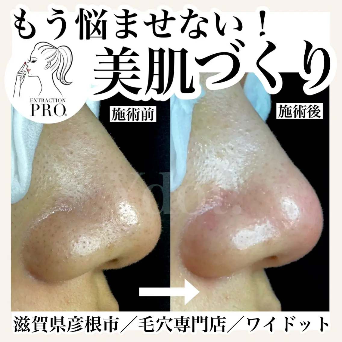 エステ Ydot. 池内 友架のエステ・リラクイメージ