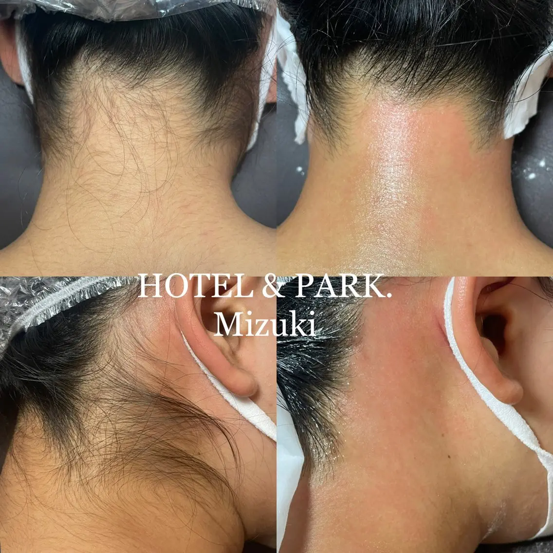 脱毛 HOTEL&PARK . ワックス脱毛のエステ・リラクイメージ