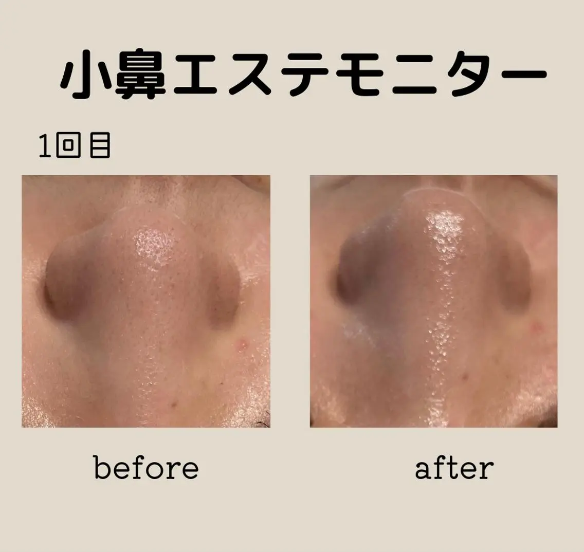 エステ 小林 玲菜のエステ・リラクイメージ