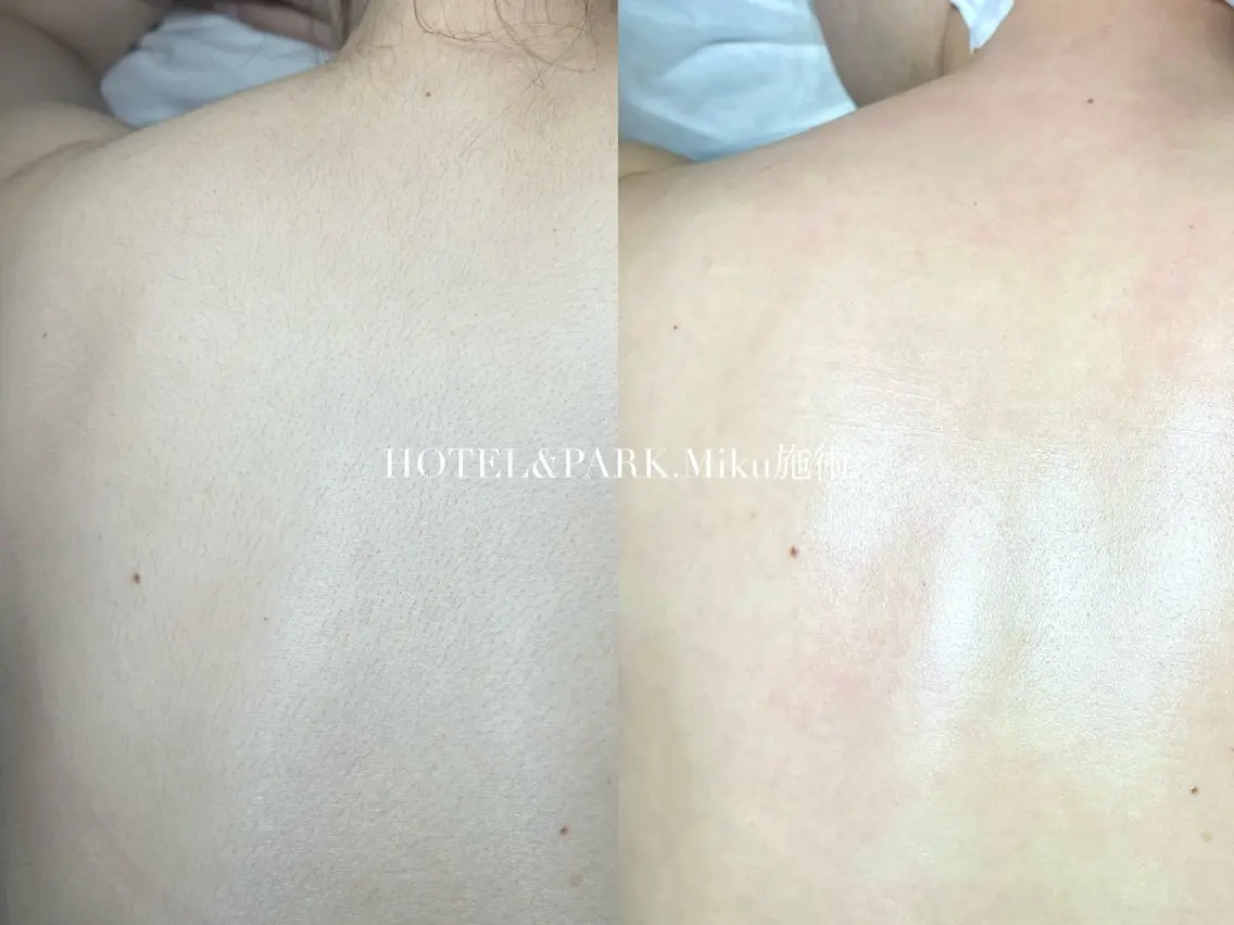HOTEL&PARK Mikuワックス脱毛のエステ・リラクイメージ