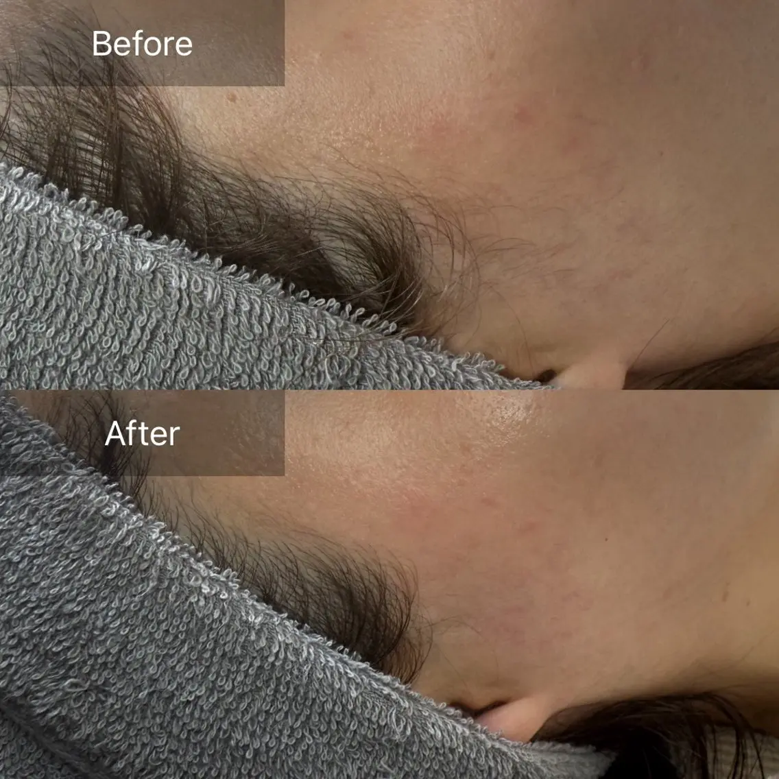 脱毛 enine フェイスWAXのエステ・リラクイメージ