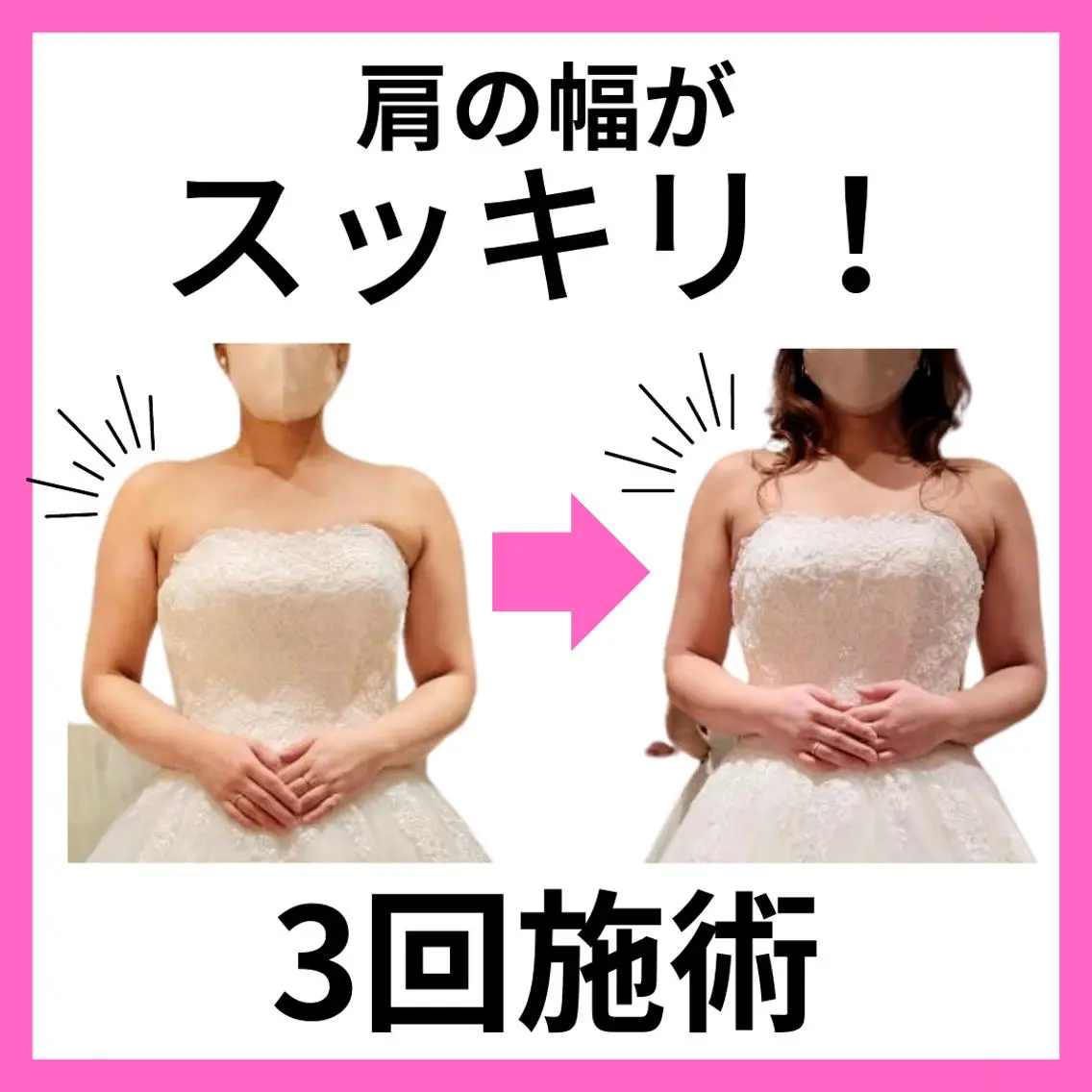 ミディアム カラー パーマ ヘアアレンジ メンズ キッズ ネイル マツエク・マツパ アイブロウ 結婚式・ブライダル 結婚式・ブライダル ブライダルネイル さくら夙川駅徒歩3分 最新韓国施術|脚やせのエステ・リラクイメージ