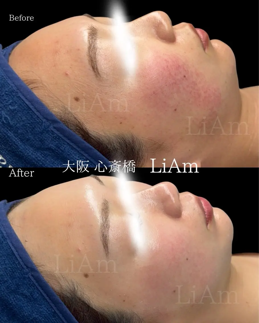 LiAm《韓国管理/ 小顔/脂肪ケア》のエステ・リラクイメージ