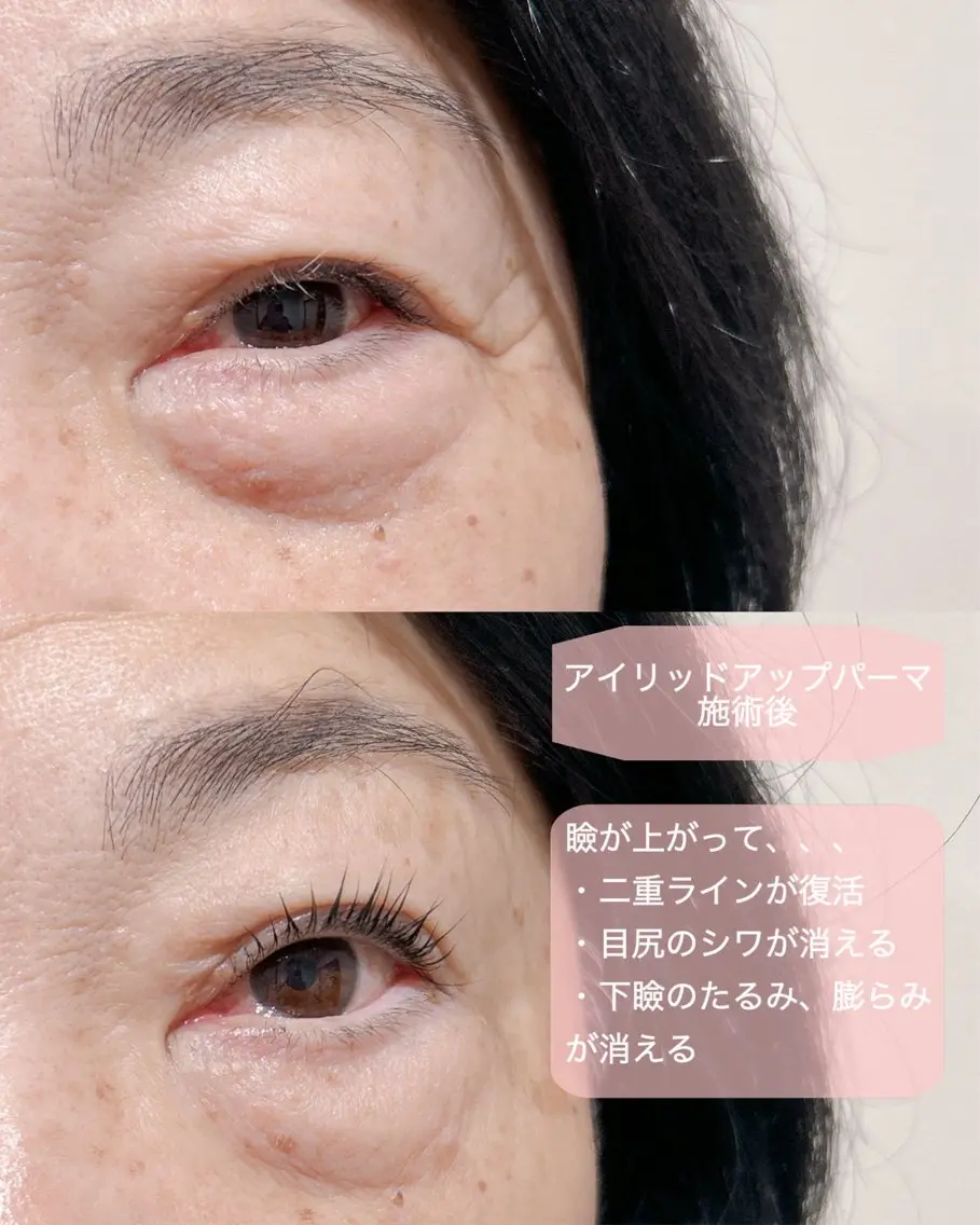 マツエク・マツパ アイリッドアップパーマ 一重×まつ毛パーマ マツパ まつげ/整体/にきび ・アトピー専門サロンのマツエク・マツパデザイン