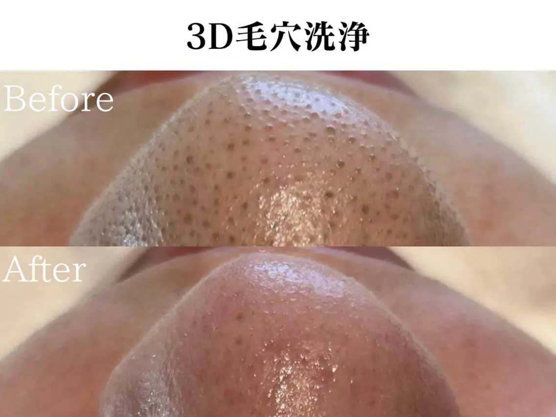 🌿OmoteAri 心斎橋✨エステサロンのエステ・リラクイメージ
