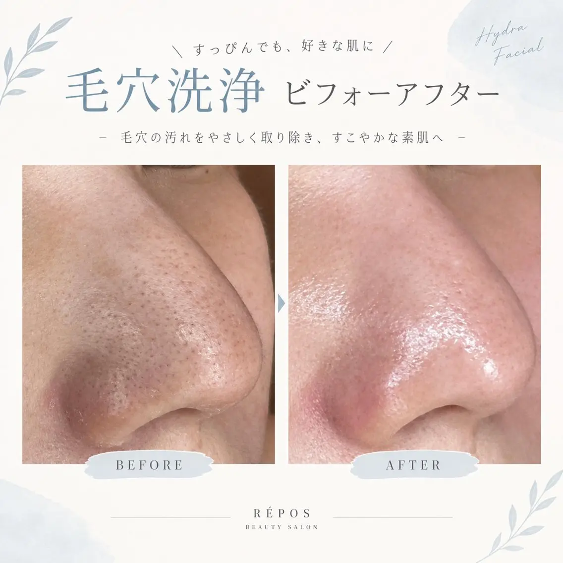 その他 毛穴・肌質改善サロン réposのその他イメージ