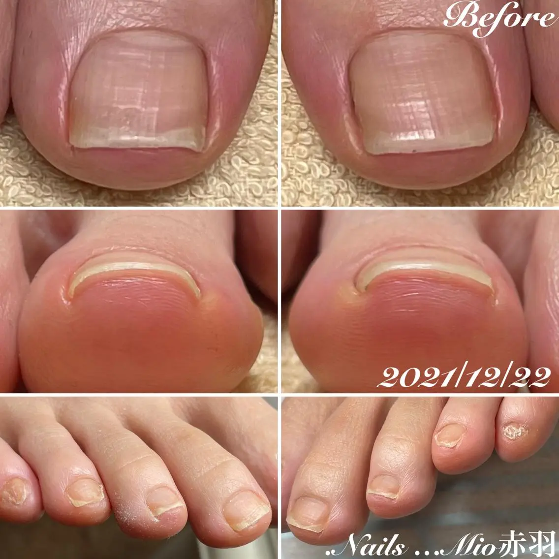 ネイル フットネイル .Nails Mio 赤羽西ネイルサロンのネイルデザイン