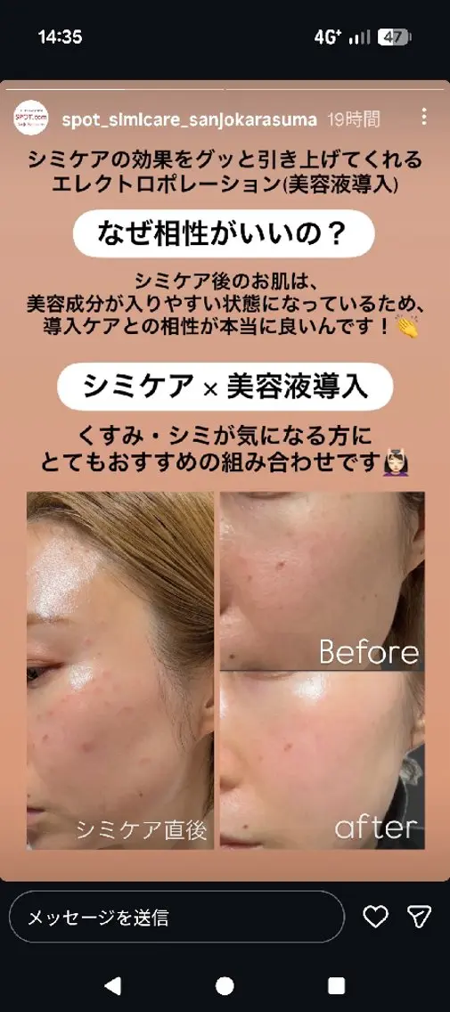 SPOT.com  シミケア専門店のエステ・リラクイメージ