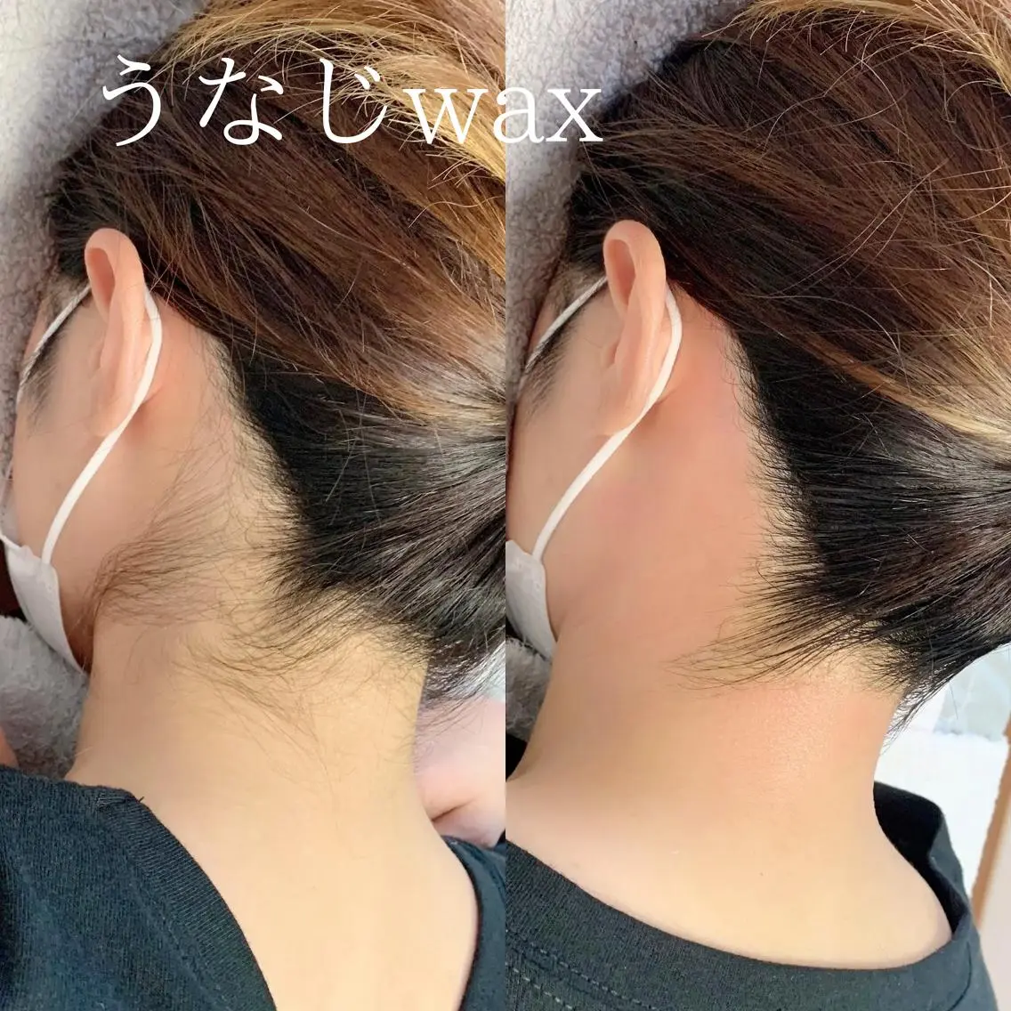 脱毛 稲嶺 美華のエステ・リラクイメージ