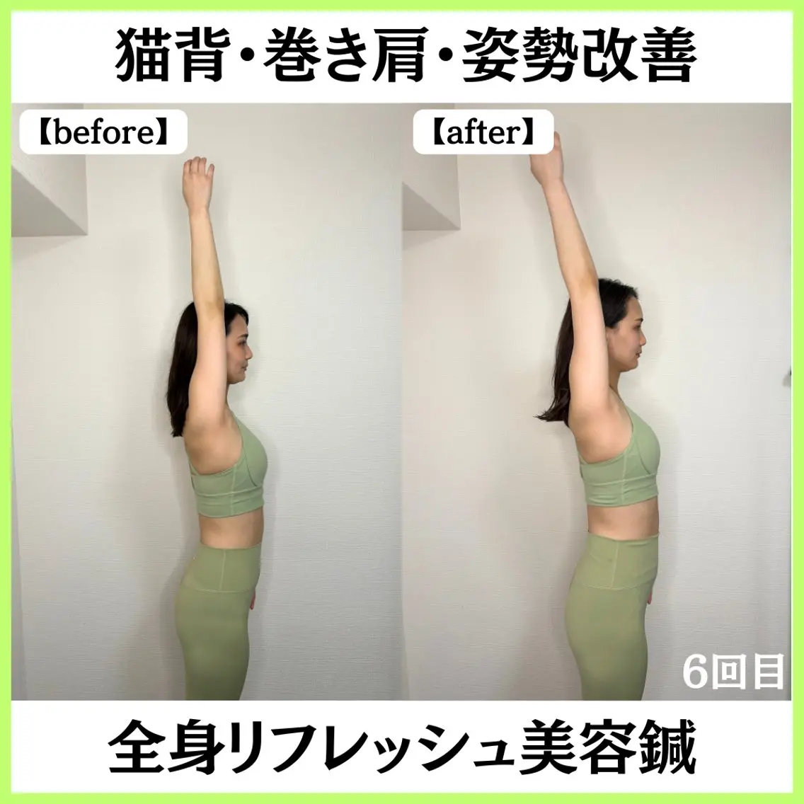 美容鍼サロン ボディコンディションのエステ・リラクイメージ