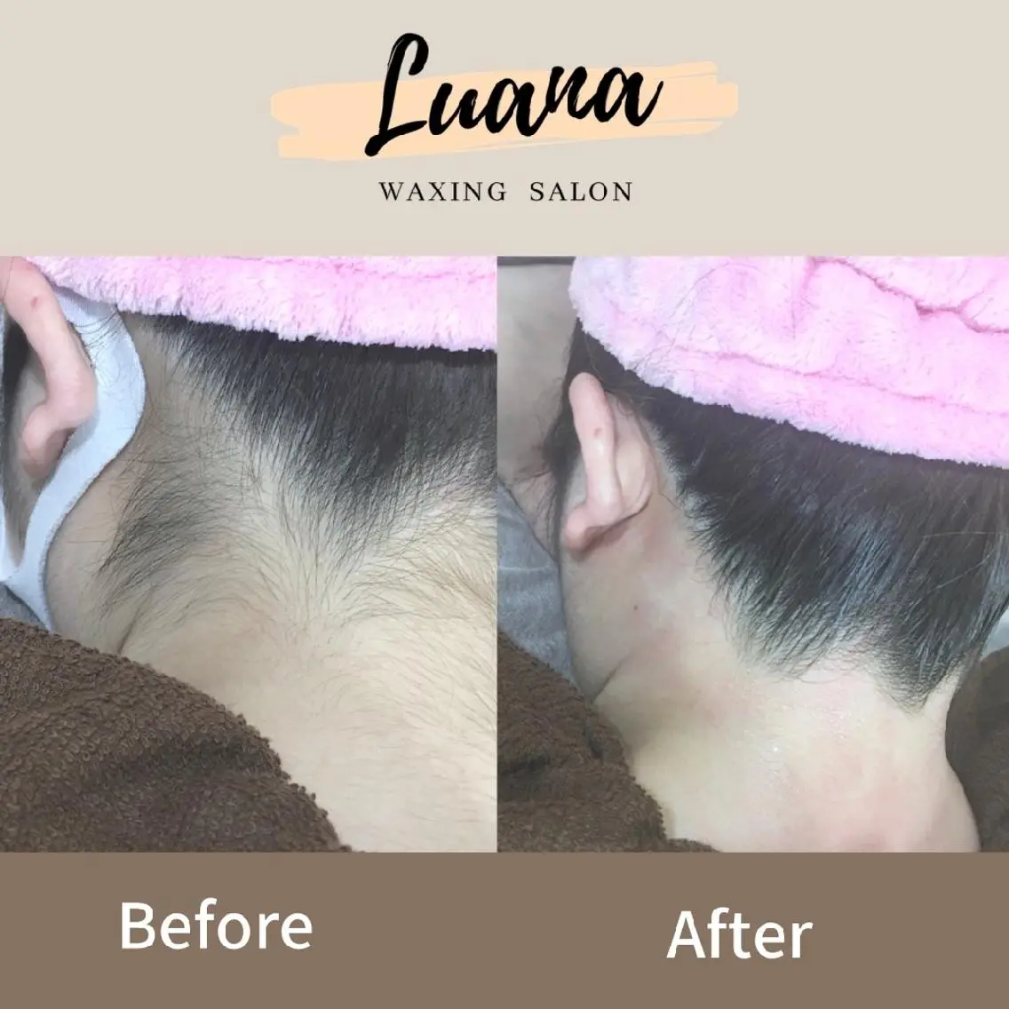 脱毛 Luana wax 🐚根本のエステ・リラクイメージ