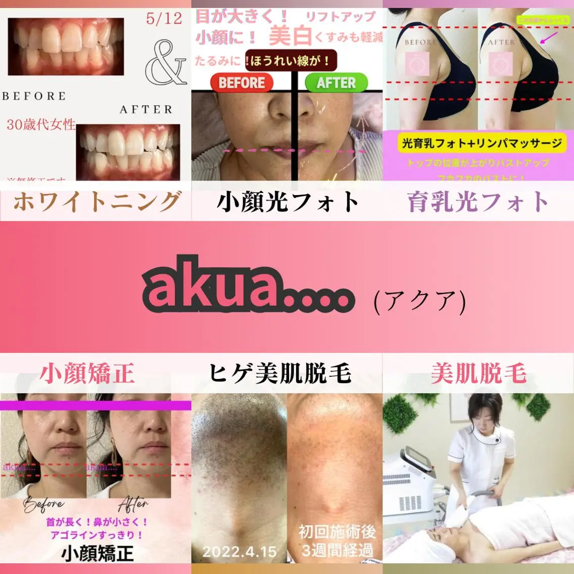 LUMINAルミナ 【肌管理サロン】のその他イメージ