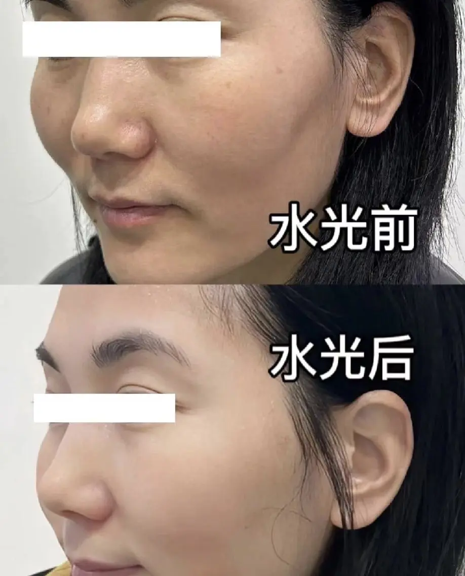 マツエク・マツパ エステ 愛維美水光専門店 川崎彩鳳のエステ・リラクイメージ