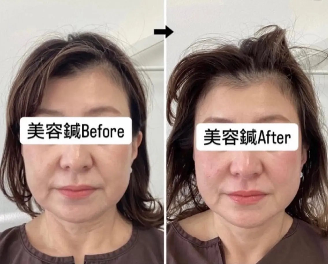 その他 美容鍼灸×小顔整体♡ ハリサロンドオフ堺東のその他イメージ