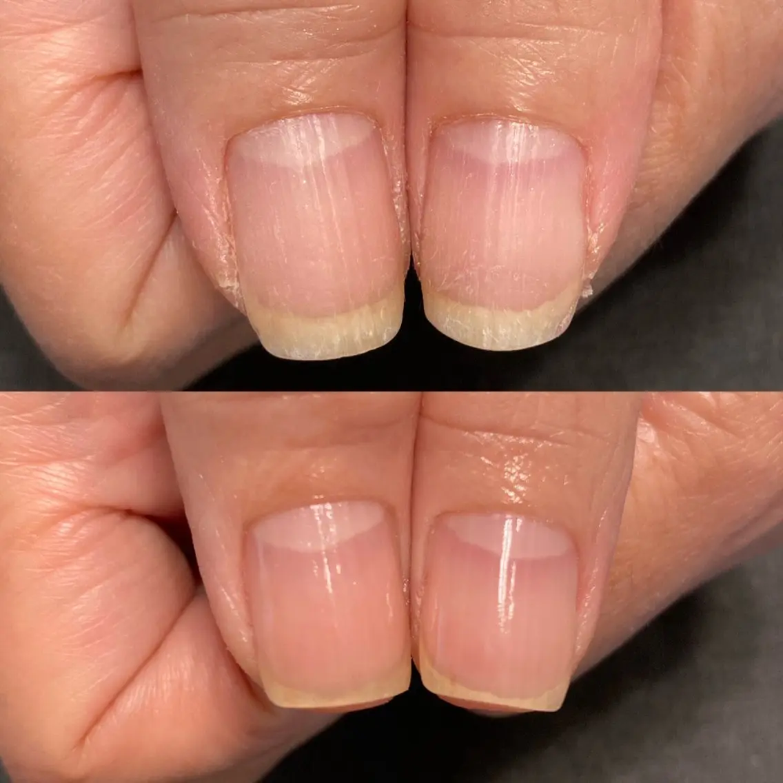 ネイル 地爪育成💅 kanaoanailのネイルデザイン