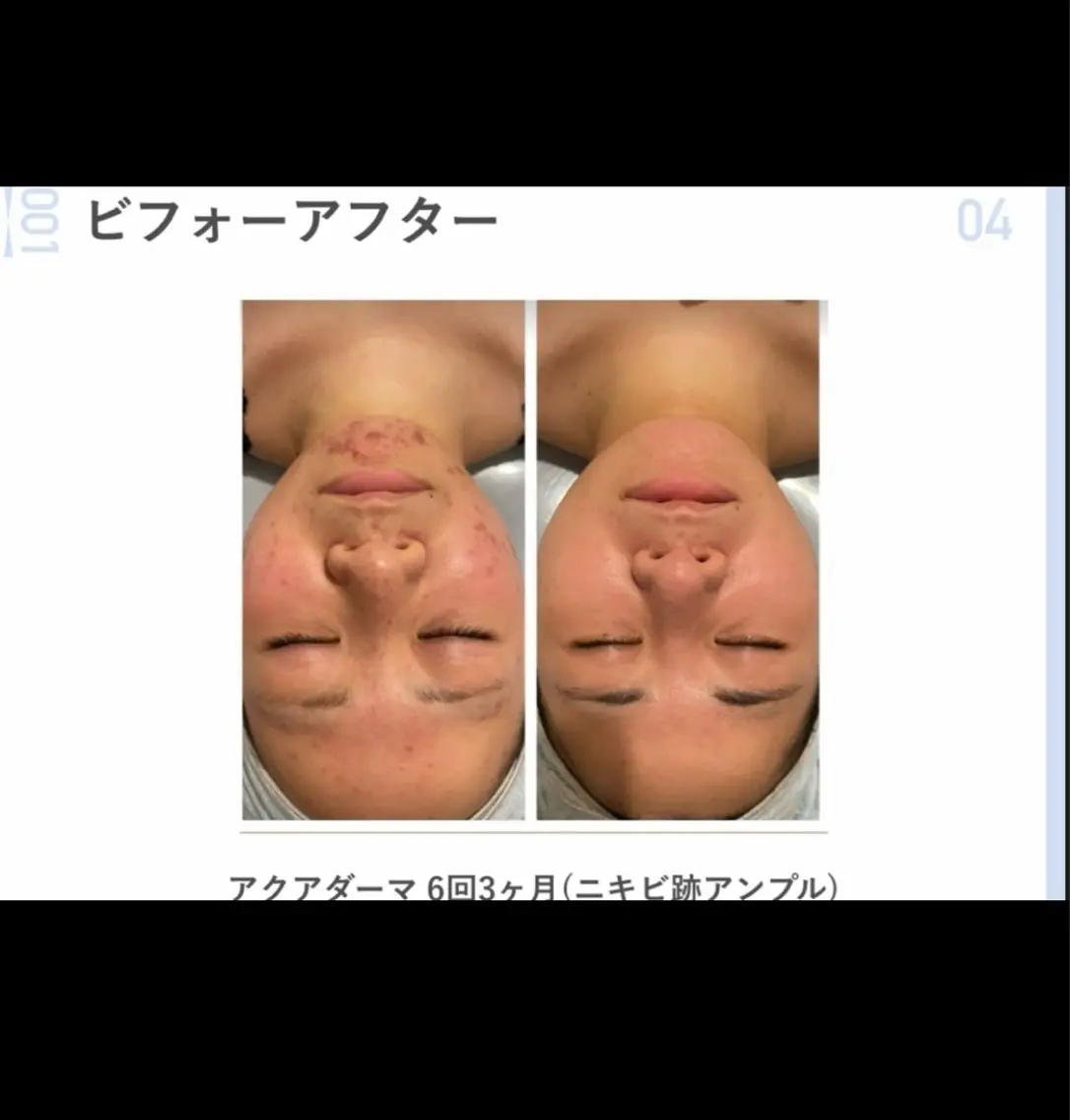エステ 看護師が施術する美容 サロン/HIDAKAのエステ・リラクイメージ