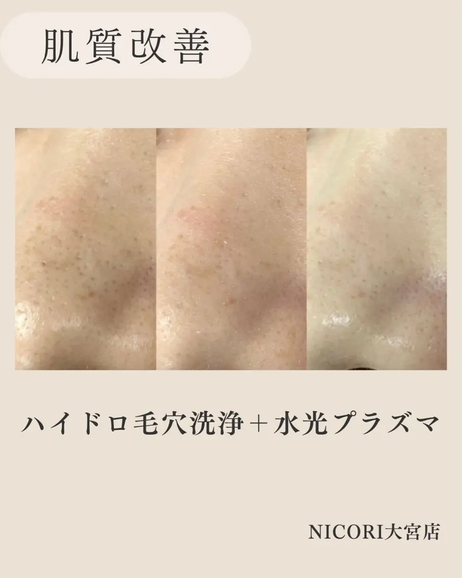 小顔＆肌質改善 NICORIのエステ・リラクイメージ