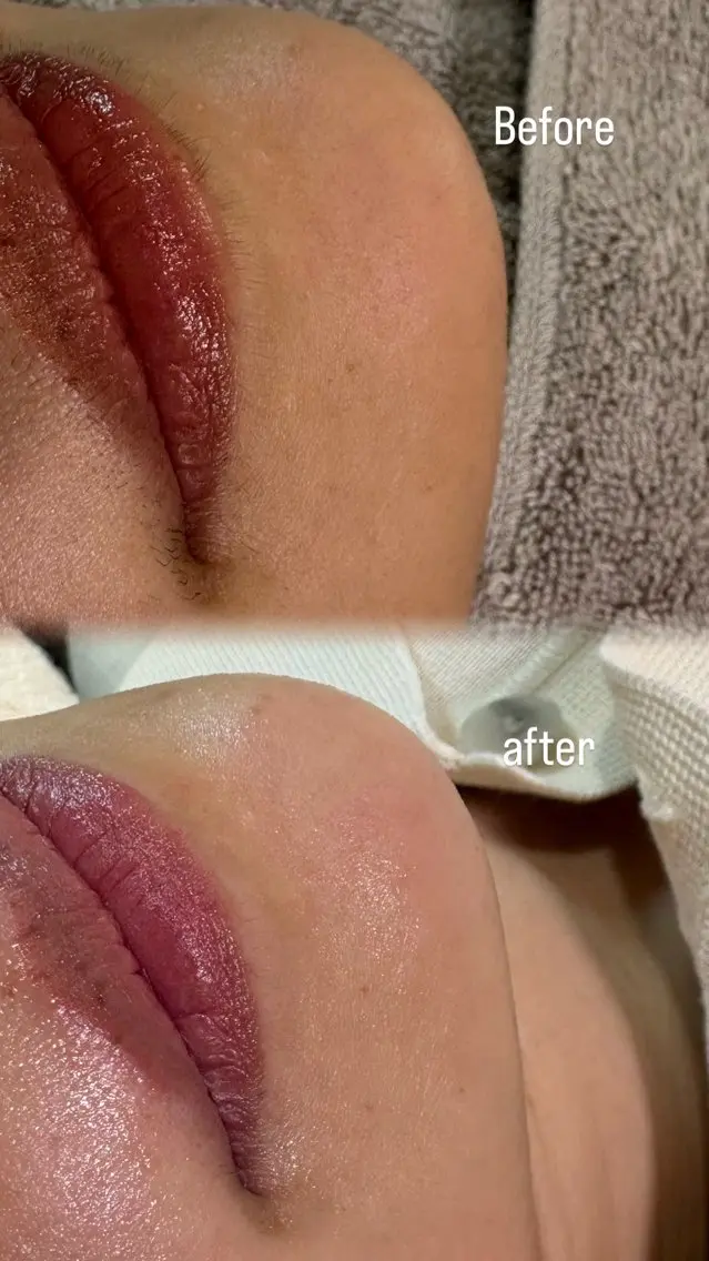 パーツwax🍯🪄『口周り』•『鼻』•『あご』いずれか1箇所の写真