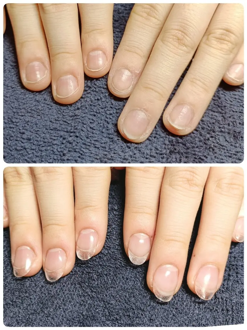 ネイル クリアネイル 長さ出し ハンドネイル ハンドケア 深爪矯正/爪育成ケア manie nailのネイルデザイン