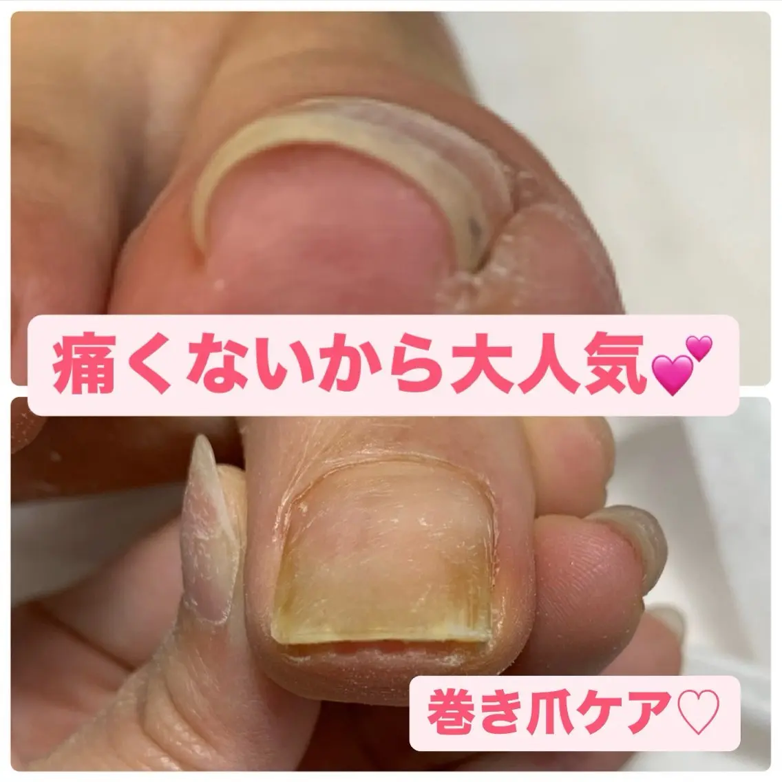 ネイル その他(ネイル) カンナ Kotonaのネイルデザイン