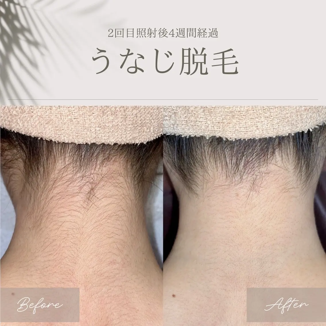 脱毛サロン ATENAのエステ・リラクイメージ