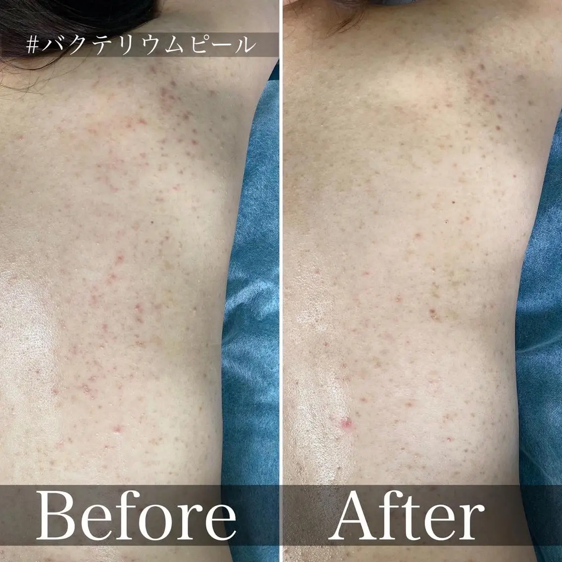 メンズ歓迎🙆‍♀️ エステ/ネイルISTのネイルデザイン
