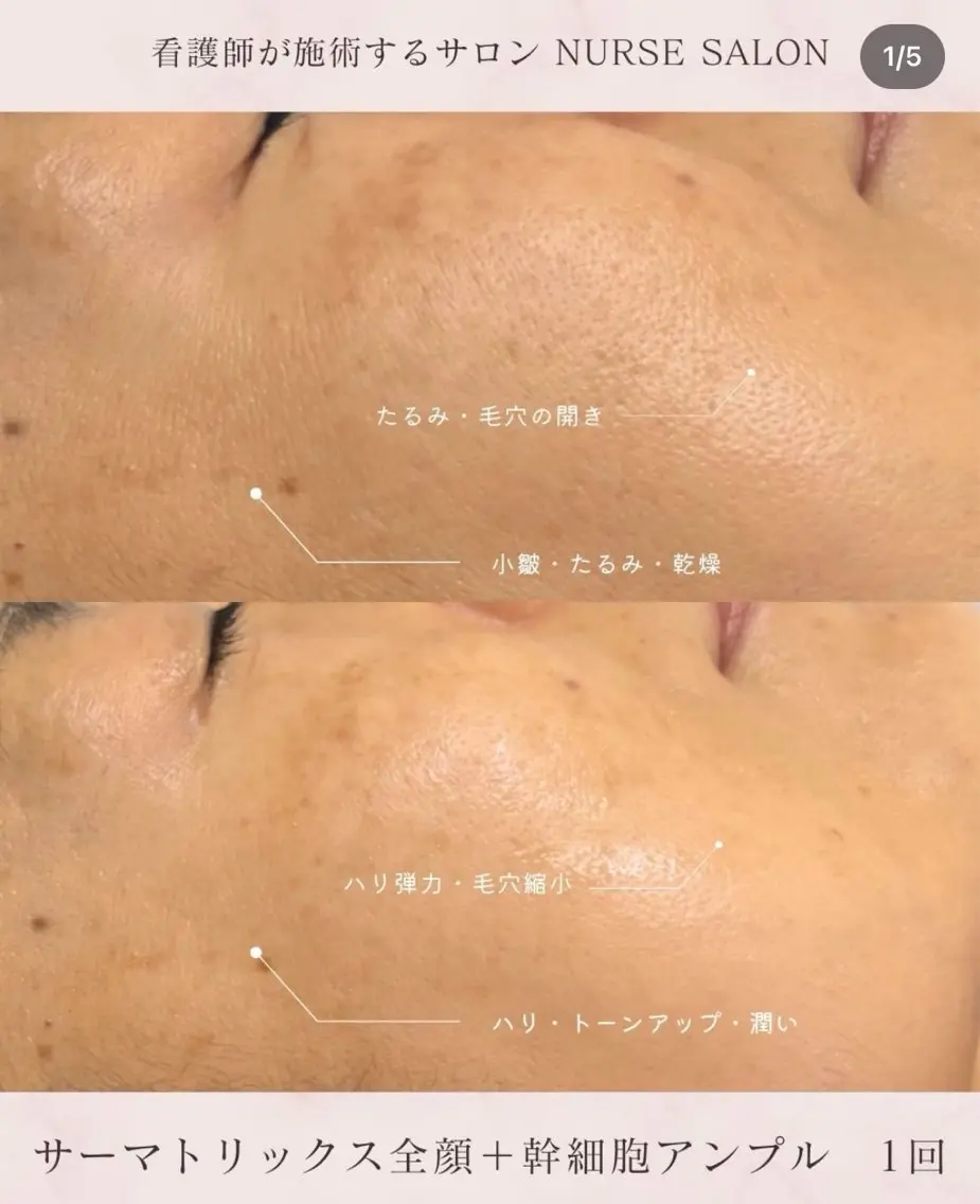 美肌・小顔専門🪄 看護師施術/松﨑のエステ・リラクイメージ