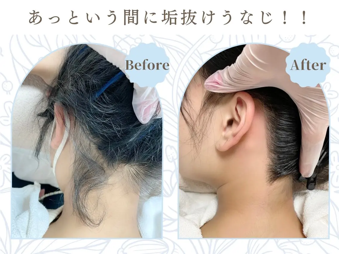 LunaBaby 金山店のエステ・リラクイメージ