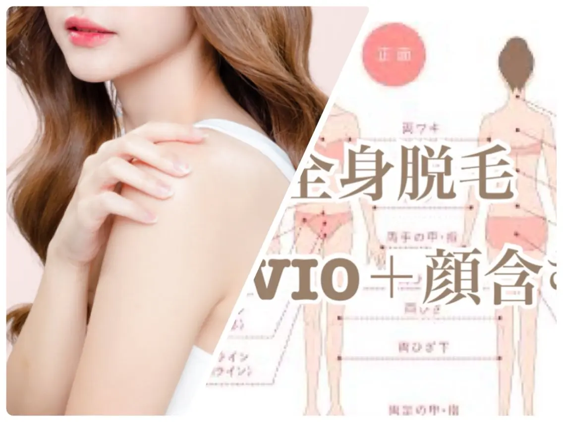 【期間限定🌸🌸】保湿ケア付きIPL脱毛◎全身+VIO+顔脱毛1回🩵の写真