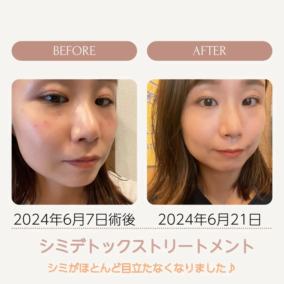 エステ vary  clue MISAのその他イメージ