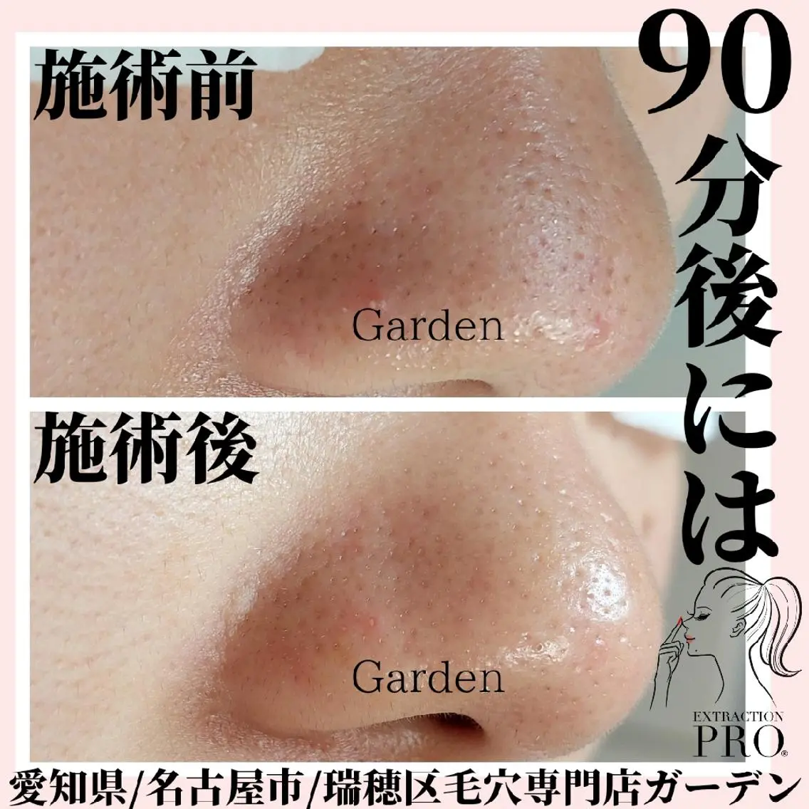 プライベートサロン Gardenのエステ・リラクイメージ